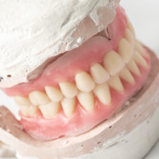 Denture Denturist Montreal