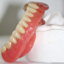 Lower denture Denturist Montreal